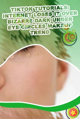 Dark circle trend